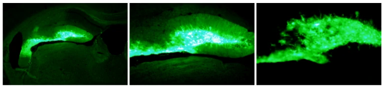 transduction results of AAV9-GFP in mouse hippocampus
