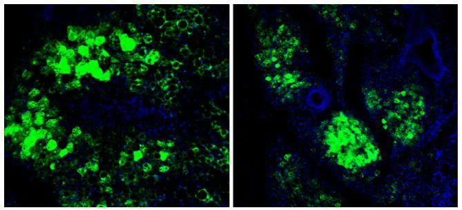 transduction of AAV9-GFP in mouse fat tissue