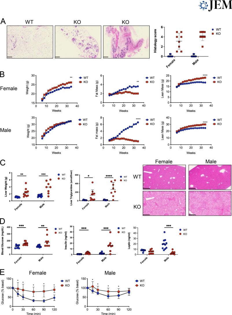 Missing Helios: Why Do Regulatory T Cells Go Out of Control?