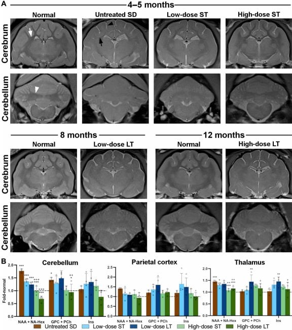 Figure 3 치료가 MRI 구조와 MRS 대사물질을 부분적으로 회복