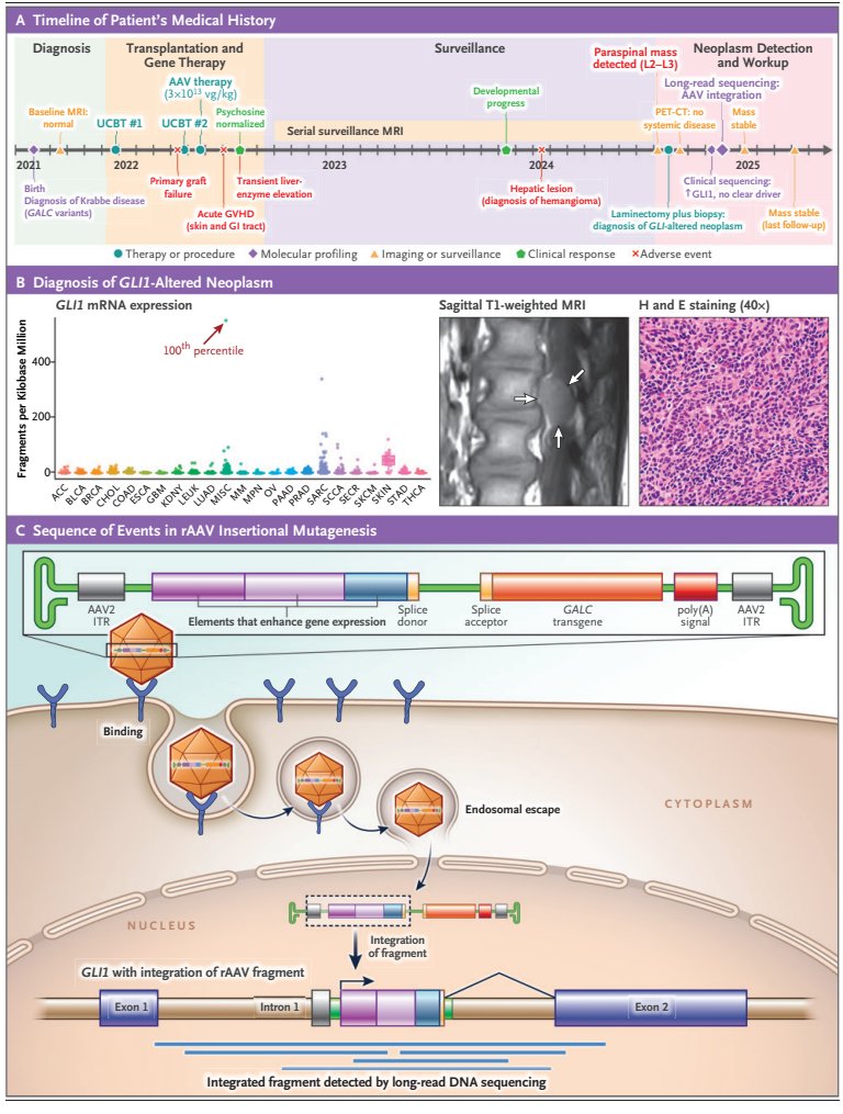 AAV Vector Integration and Tumorigenesis: Mechanistic Interpretation of a Tumor After Gene Therapy in a Child